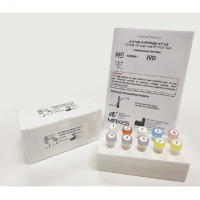 COVID-19 Real-Time RT-PCR Test