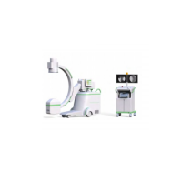 Mobile Digital C-Arm System