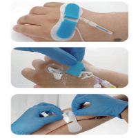 IV Start Fixation Device