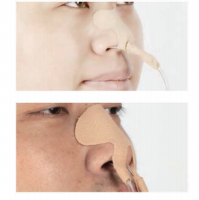 Nasogastric Tube Fixation Device