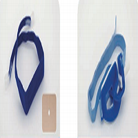 Endotracheal Tube Fixation Device