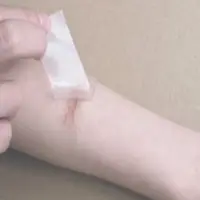Scar Healing Stickers