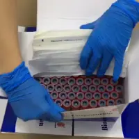 Swabs - Nasal, Pharyngeal