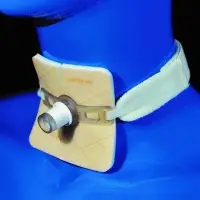 Advazorb Plus (t) Tracheostomy Dressing