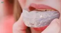 Mouth Guard