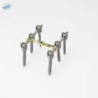 Spine Implant