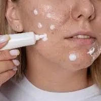 Acne Care