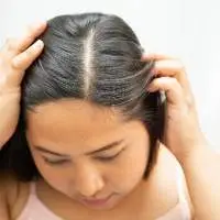 Scalp Care
