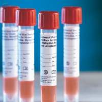 Viral Transport Kit