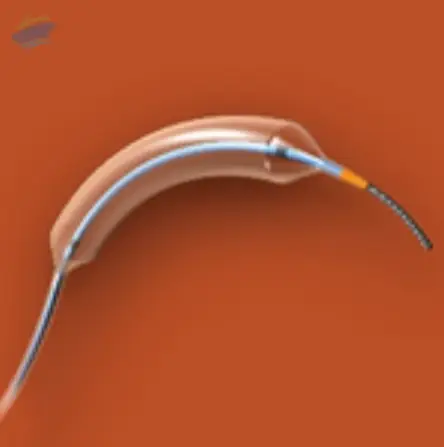 NC Trek Catheter 2.5mm