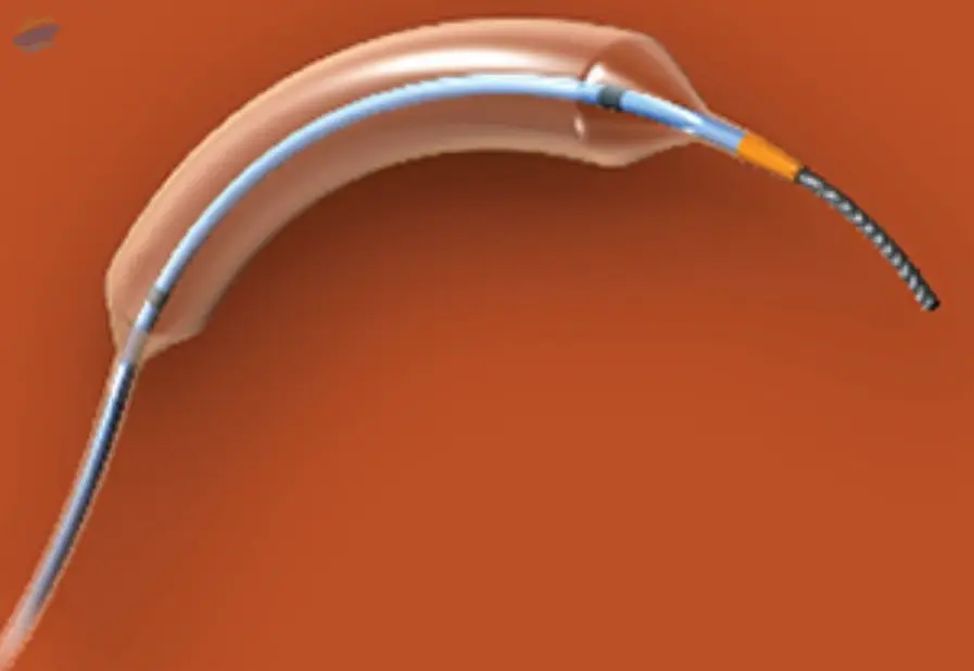 NC Trek Catheter 2.5 mm x 8 mm
