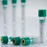 Venous Blood Collection Tube 13 X 100 5 ml