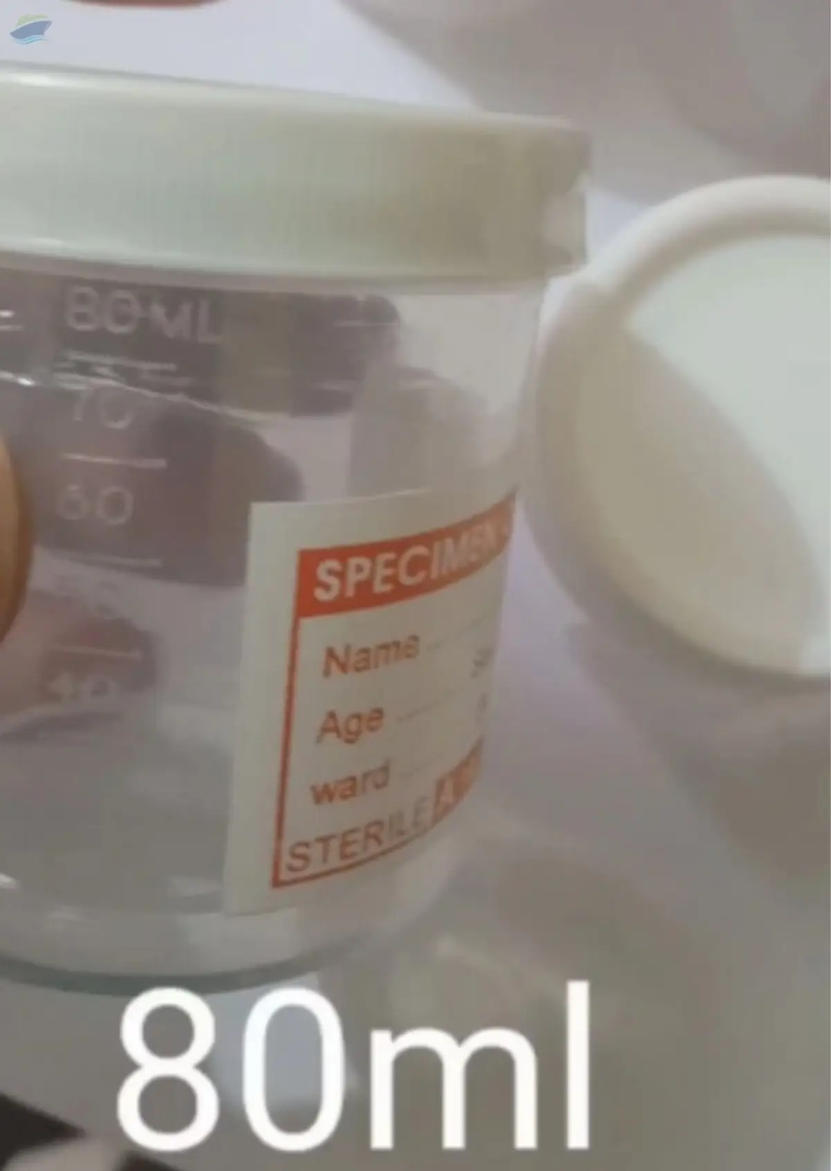 Urine, Sputum  And  Sample Container