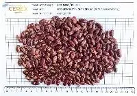 Red Speckled Kidney Beans