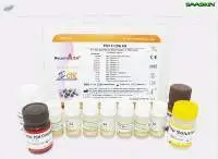 RecombiLISA TSH ELISA kit