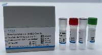 RT-PCR Detection Kit (Real time RT-PCR kit)