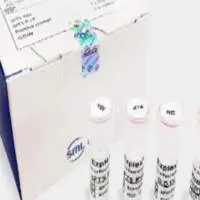 Korean SFTS Virus Real-time PCR Kit