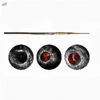 Volcano Visions Pv .014p Rx Digital Ivus 150cm