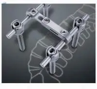 Korean Pedicle Screw Vane System
