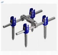 Korean Pedicle Screw Solar 3 System