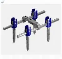 Korean Pedicle Screw Solar 3 System
