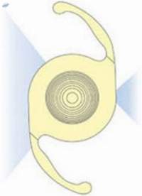 Multifocal Intraocular Lens