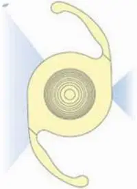 Multifocal Intraocular Lens