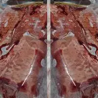 All Meat Products